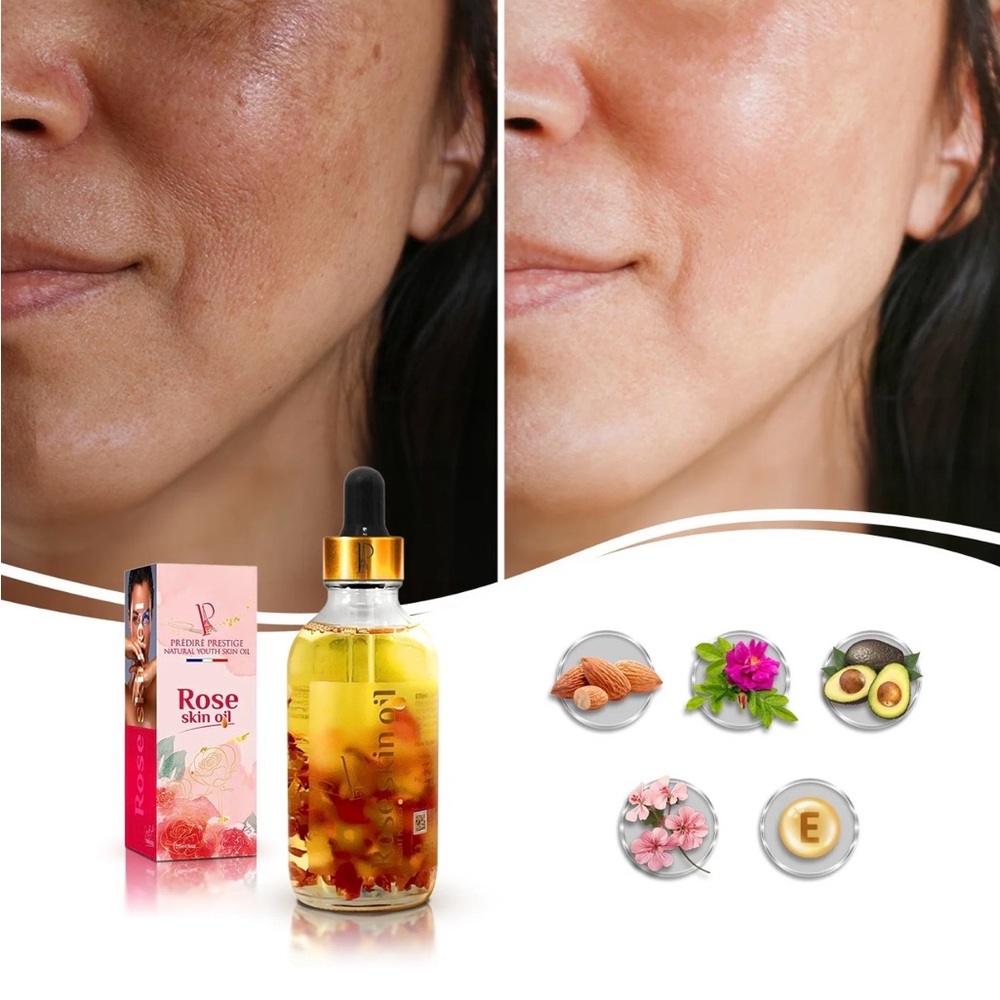 Rose Skin Oil - Picture 8 of 11